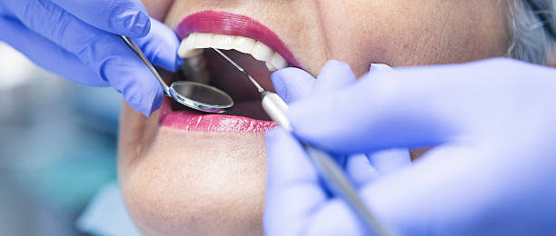 Best Emergency Treatment for Dental Infections or Abscesses in Omak, WA